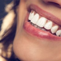 Why Whitening of Teeth Make You Look Attractive?