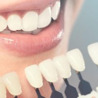 Cosmetic Dentistry: The Celebrity Smile Available to Everyone