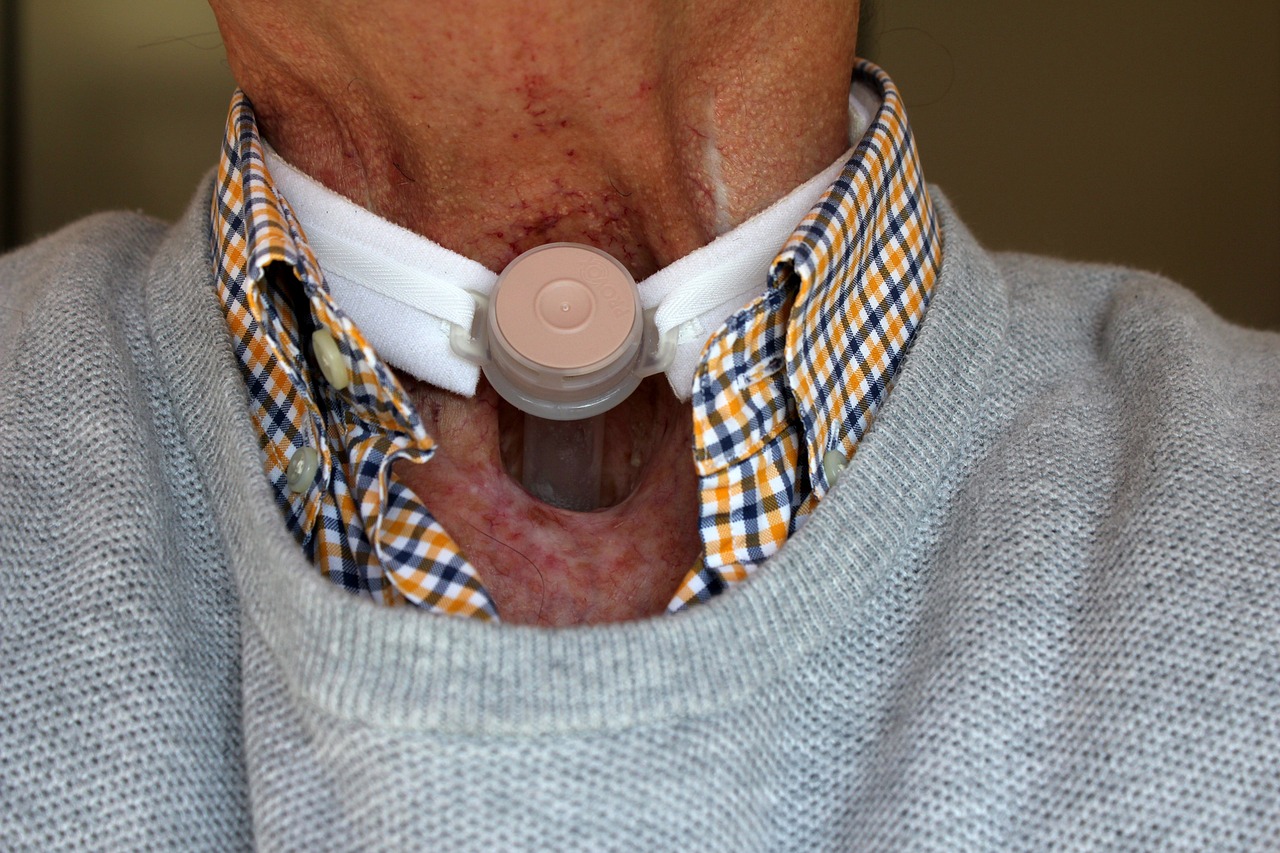 Disability, laryngectomy, surgery — Answering Faqs About Top Surgery For Transgender