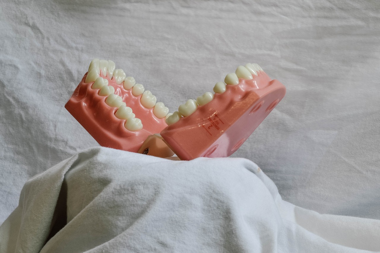 Teeth, dental, dental model — Be One Step Ahead of Your Competition Through Internet Dental Marketing